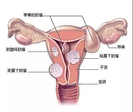 【<a href=demo2.html target=_blank class=infotextkey>加博士</a>醫(yī)囑】濕氣太重，女(nǚ)人(rén)太累，而且危害無窮