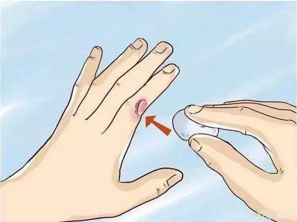 春季皮膚病高(gāo)發，止癢消腫